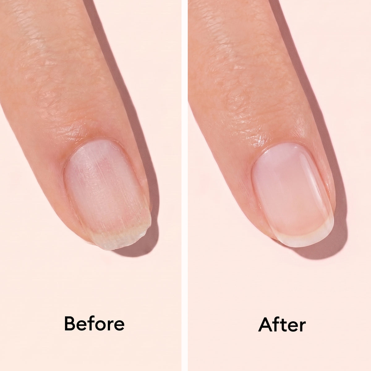 Close-up of a fingertip shows a "before" with dry, peeling cuticles and an "after" with smooth, healthy skin after using Manucurist Nail Strengthening Serum. Text labels Before and After appear beneath each side.