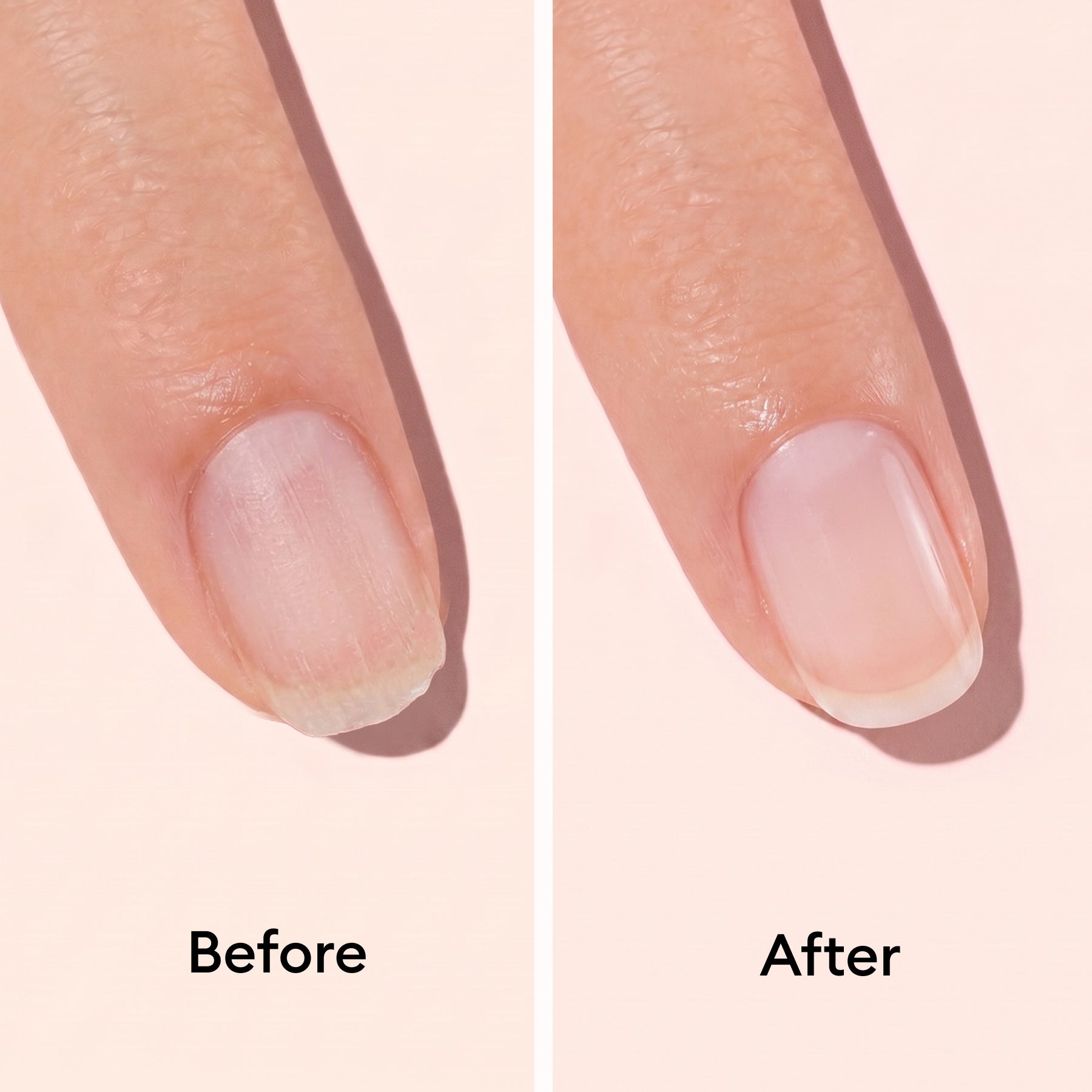 Close-up of a fingertip shows a "before" with dry, peeling cuticles and an "after" with smooth, healthy skin after using Manucurist Nail Strengthening Serum. Text labels Before and After appear beneath each side.